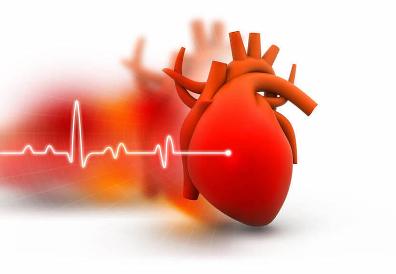 Killer heart disease image showing a heart tracing and the diagram of the human heart